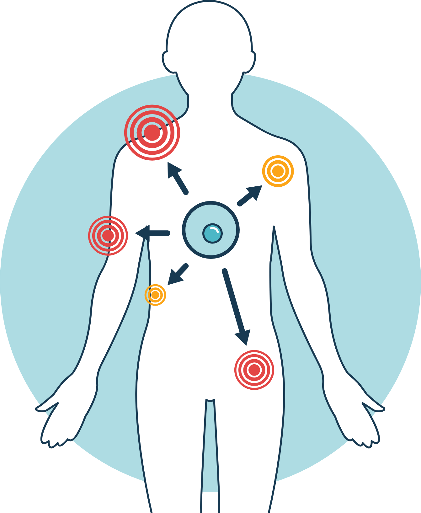 幹細胞治療の役割イメージ